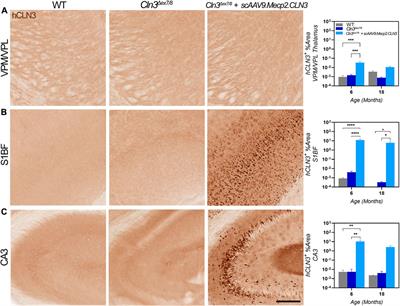 Early postnatal administration of an AAV9 gene therapy is safe and efficacious in CLN3 disease